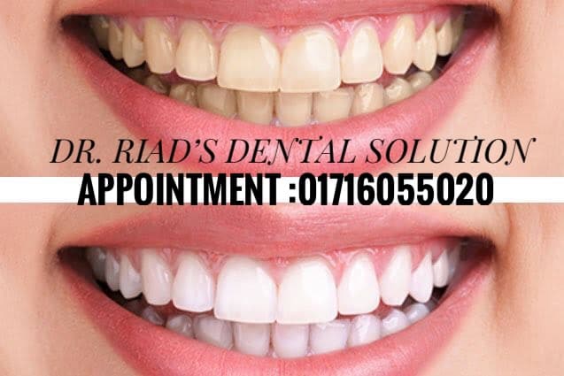 places:{"author":"Dr. Riad's Dental Solution","authorUri":"https://maps.google.com/maps/contrib/101823286946068713659","mapsUri":"https://www.google.com/maps/place//data=!3m4!1e2!3m2!1sCIHM0ogKEICAgIC6lJqDjAE!2e10!4m2!3m1!1s0x3755b8b7c710f0ef:0x3314602a78385a94"}