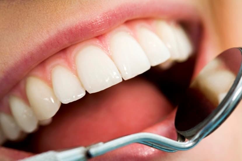places:{"author":"Tooth Planet: Cosmetic Dentistry- Orthodontics- Dental Implants","authorUri":"https://maps.google.com/maps/contrib/103328596795588582861","mapsUri":"https://www.google.com/maps/place//data=!3m4!1e2!3m2!1sCIHM0ogKEICAgICijP-WjAE!2e10!4m2!3m1!1s0x3755bf4c5759da97:0x7c38341a0d0ab80d"}