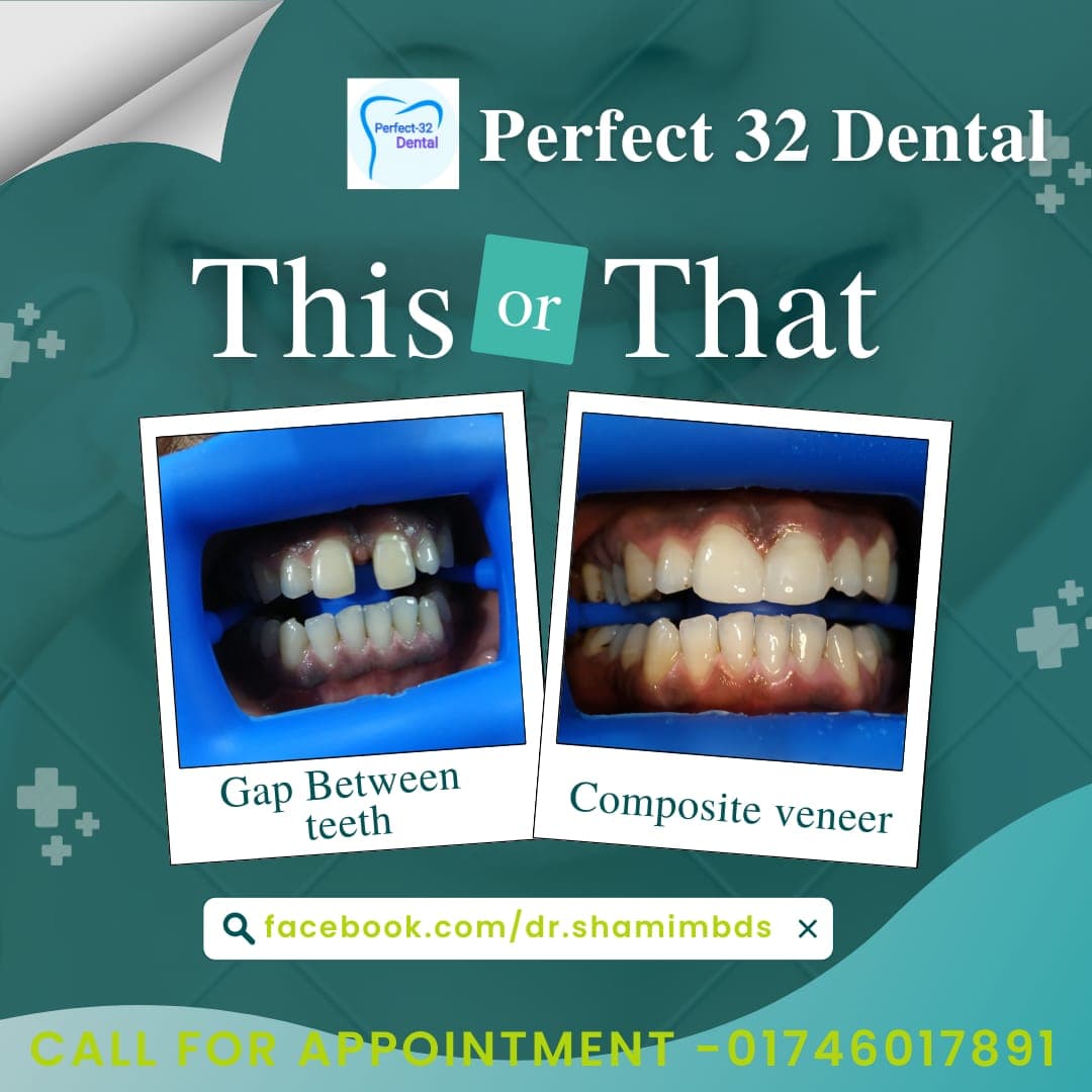 places:{"author":"Perfect 32 Dental Clinic.Best dentis dhanmondi ,dhaka","authorUri":"https://maps.google.com/maps/contrib/101458704128006429589","mapsUri":"https://www.google.com/maps/place//data=!3m4!1e2!3m2!1sCIHM0ogKEICAgIDhmNS97wE!2e10!4m2!3m1!1s0x3755b8b7c170086b:0x132b583e44d5aaab"}